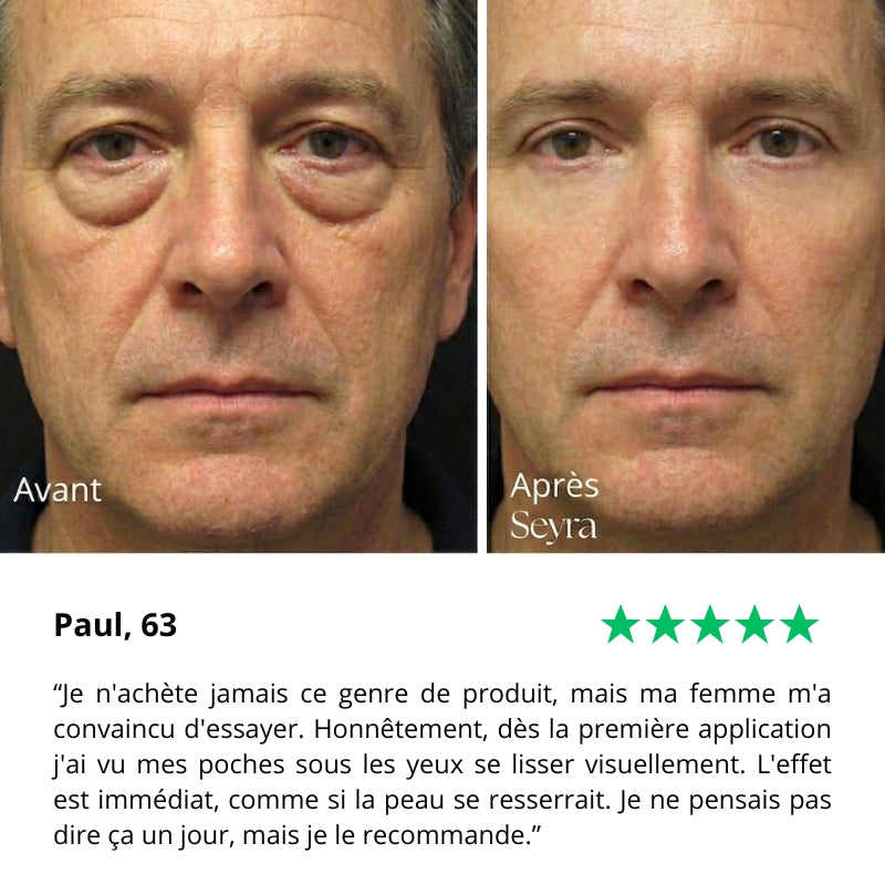 Seyra 60-Second Eye Booster
