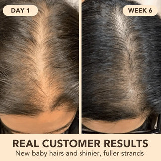 Seyra® - Pumpkin Seed Oil Softgels