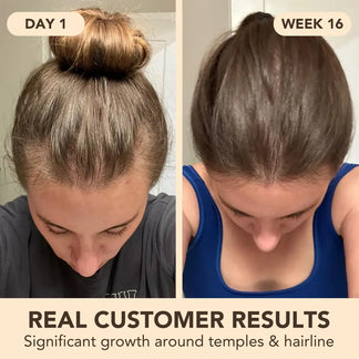 Seyra® - Pumpkin Seed Oil Softgels