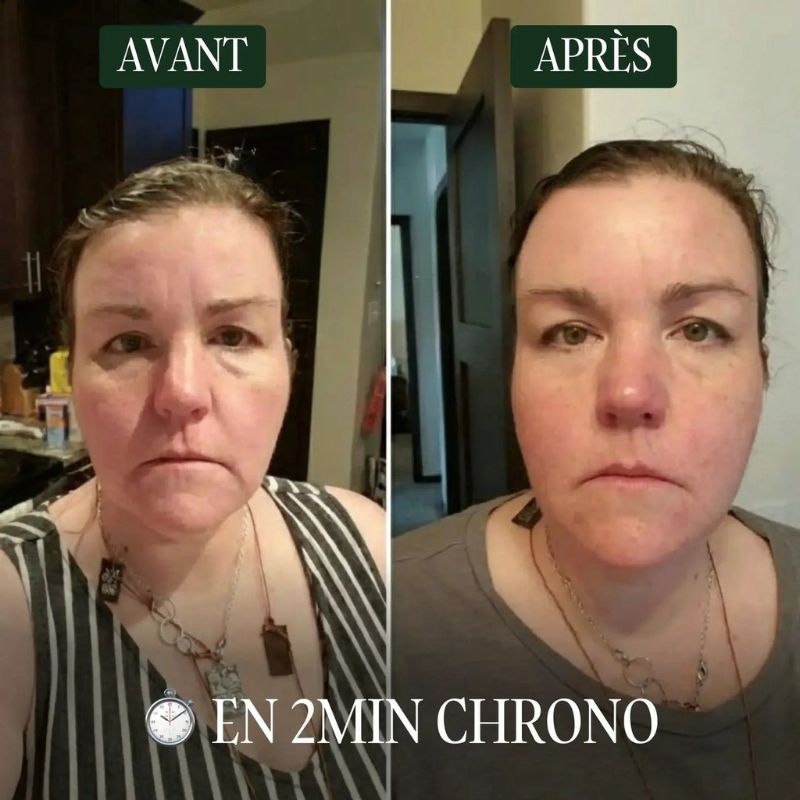 Brosse lymphatique visage