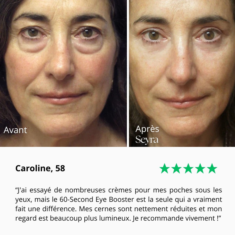 Seyra 60-Second Eye Booster