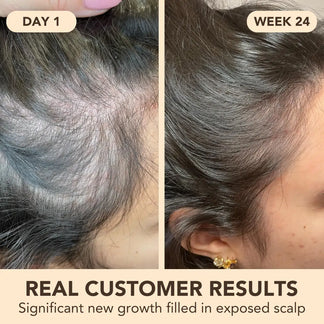 Seyra® - Pumpkin Seed Oil Softgels